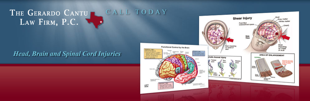 Brain injury attorney in Houston.